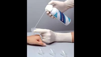 Dermafreeze Crioterapia Nitrogênio Líquido Verrugas Hpv