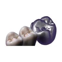 Software TruSmile DentalCAD - exocad