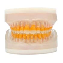 Refil Periodontia I AC104 - Pronew