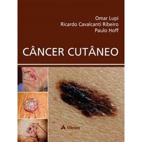 Livro - Câncer Cutâneo - Hoff - 1ª edição - Portal do Médico