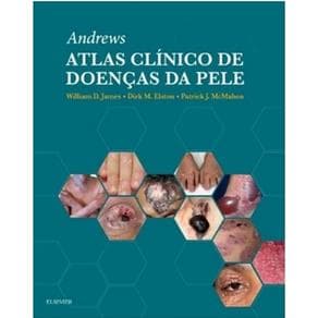 Livro -  Andrews Atlas Clínico De Doenças da Pele  - James - 1ª edição - Portal do Médico