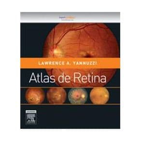 Livro - Atlas de Retina - Yannuzzi - 2ª edição - Portal do Médico