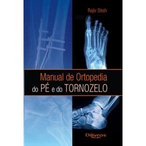 Livro - Manual de Ortopedia do Pé e do Tornozelo - Shah - 1ª edição - Portal do Médico