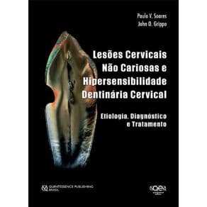 Livro - Lesões Cervicais Não Cariosas e Hipersensibilidade Dentinária Cervical: Etiologia, Diagnóstico e Tratamento - Soares - 1ª edição - Portal do Médico