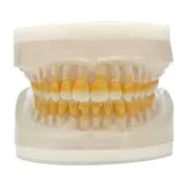 Refil Periodontia I AC 104 - Pronew