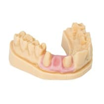 Resina para Impressora 3D Dima Print Gingiva Mask 1Kg - Kulzer