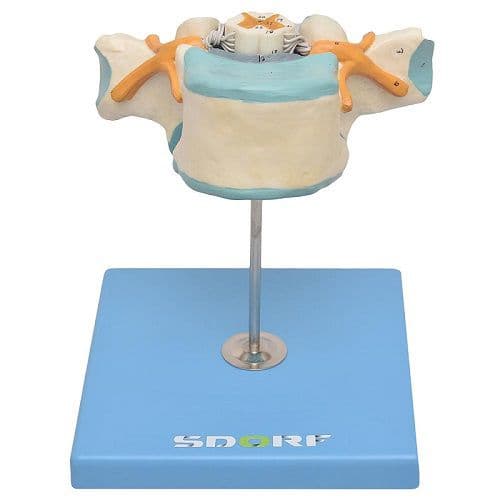 Vértebra Torácica c/ Cordão Espinhal Modelo Anatomia - Portal do Médico