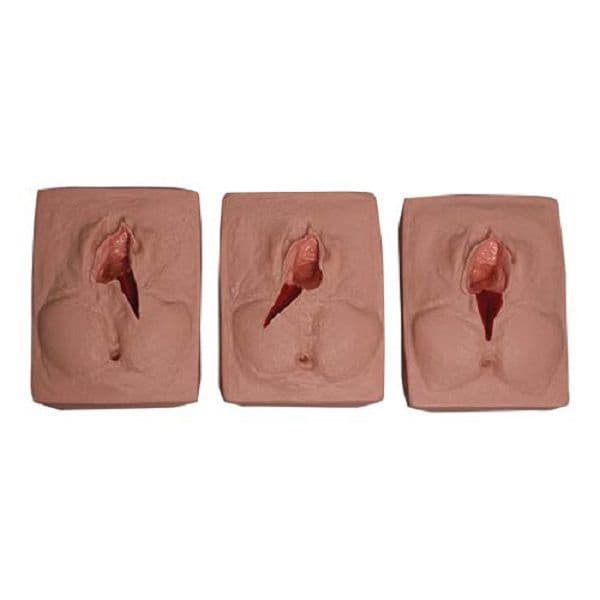 Sutura da Vulva, Simulador Médico - Portal do Médico