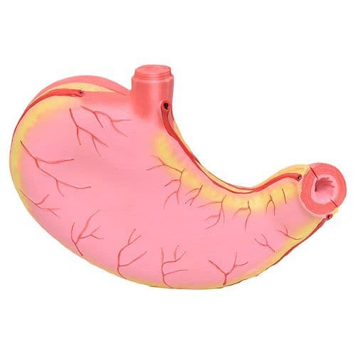 Estômago Ampliado em 2 Partes, Anatomia