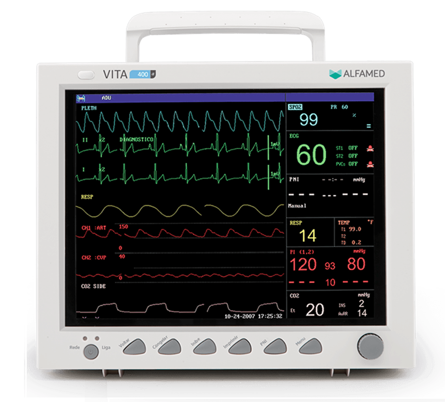 Monitor Multiparâmetro VITA 400a Básico (ECG 3/7 Deriv, Resp., SpO2, - Portal do Médico