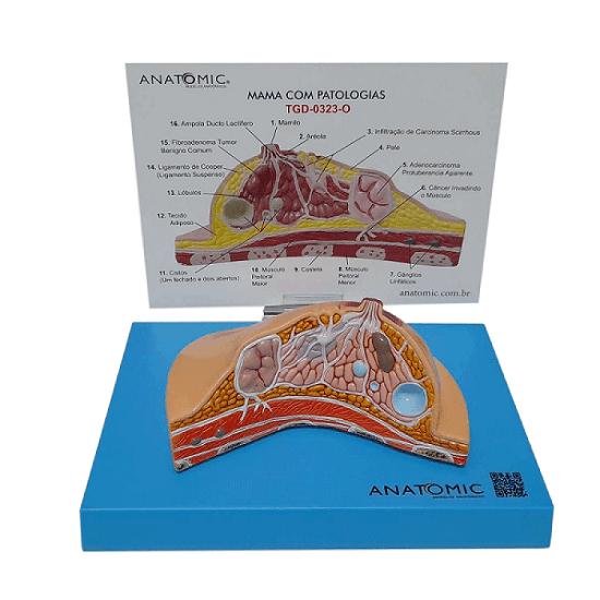 Mama dissecada com Patologias, Anatomia