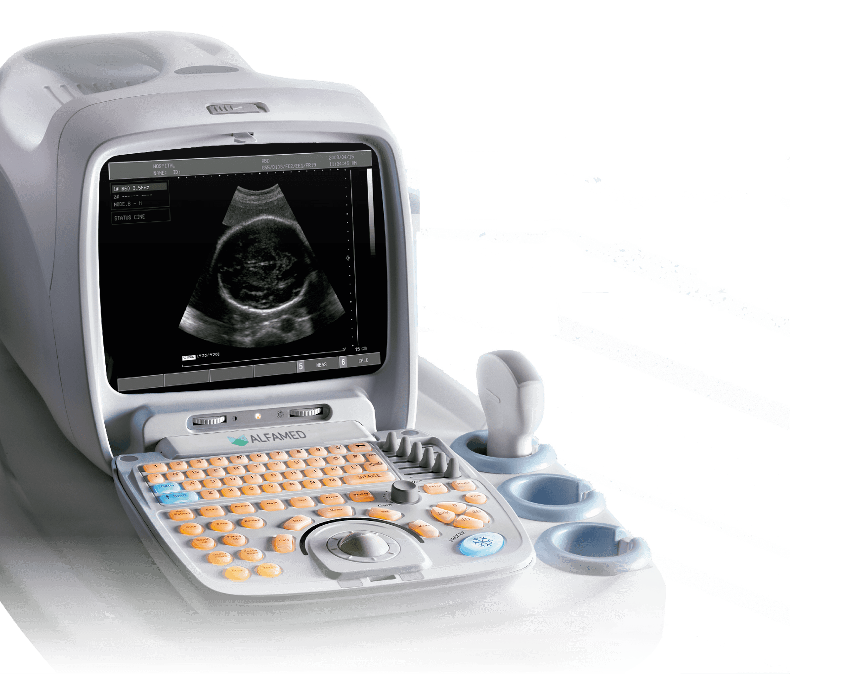 ULTRASSOM PORTATIL CLARIS 600 - ALFAMED - Portal do Médico