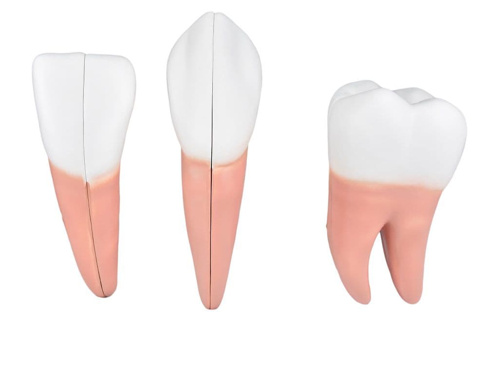 Dentes em 6 Partes (Incisivo, Canino e Molar)