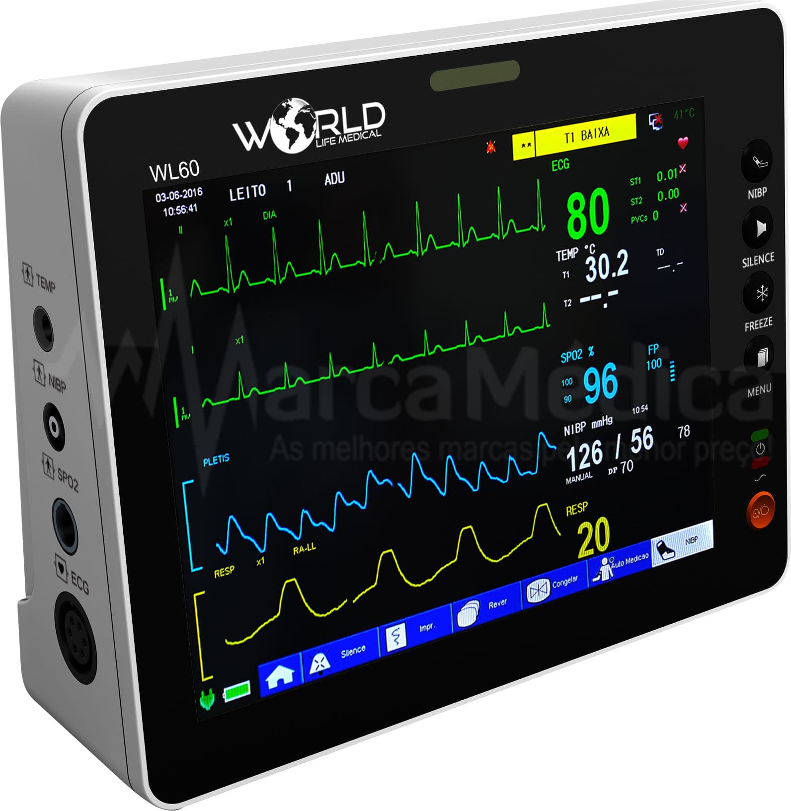 Monitor WL60 Multiparâmetros - Portal do Médico