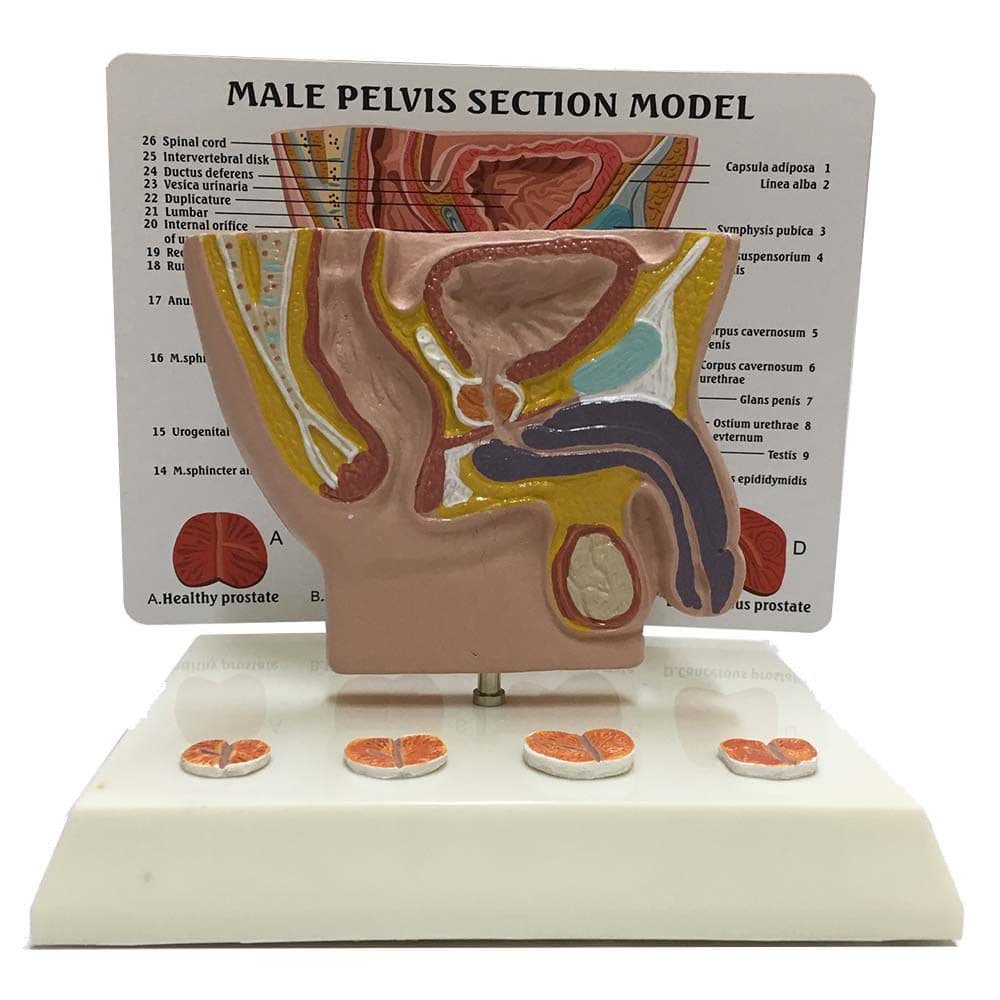 Modelo de Próstata - Portal do Médico