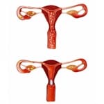 Modelo Momento da Fecundação -Anatomic - Portal do Médico