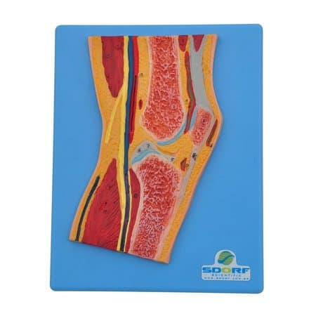 Secção Mediana do Joelho - Portal do Médico